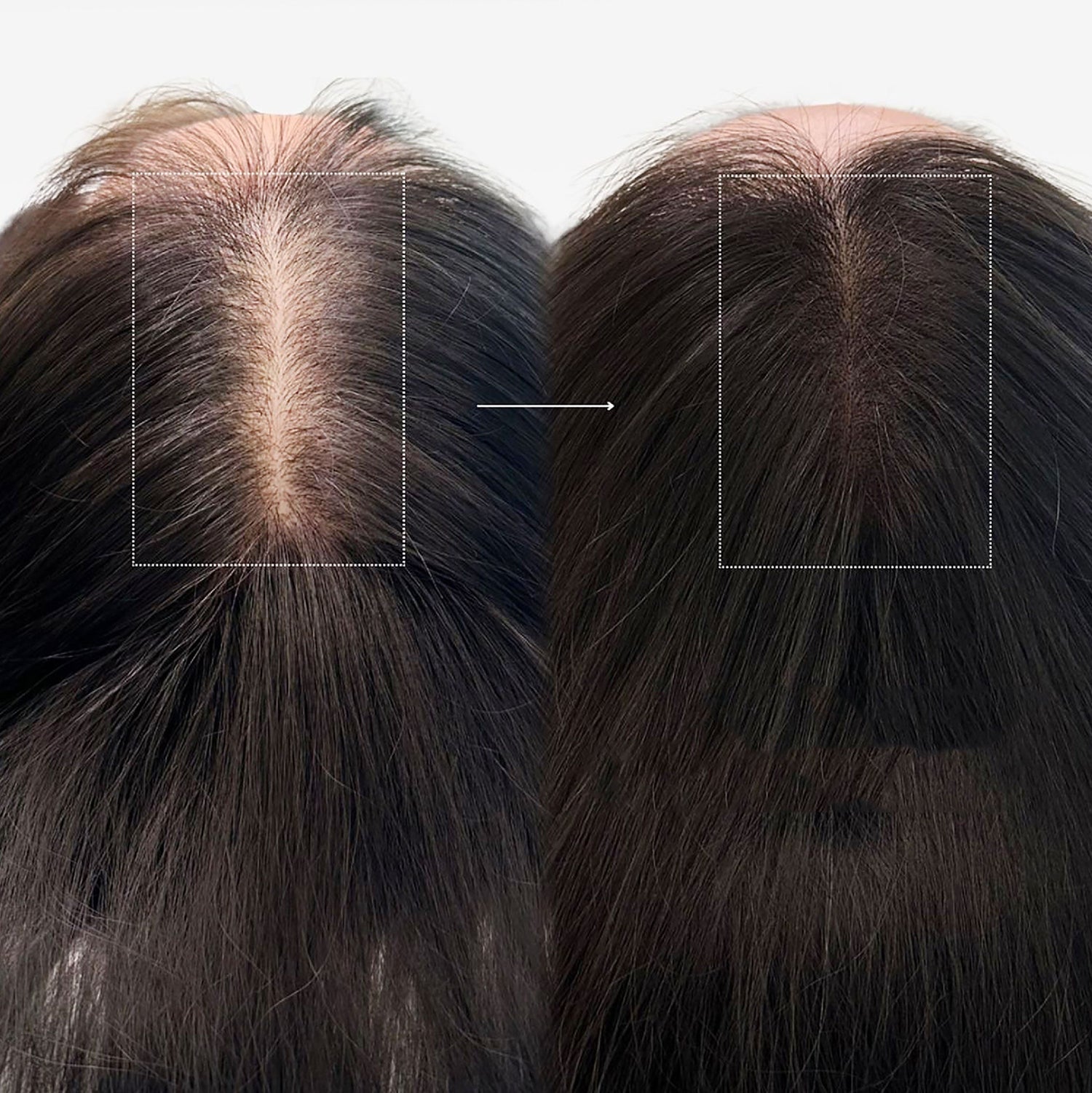 CLOVEE Hair Booster Serum