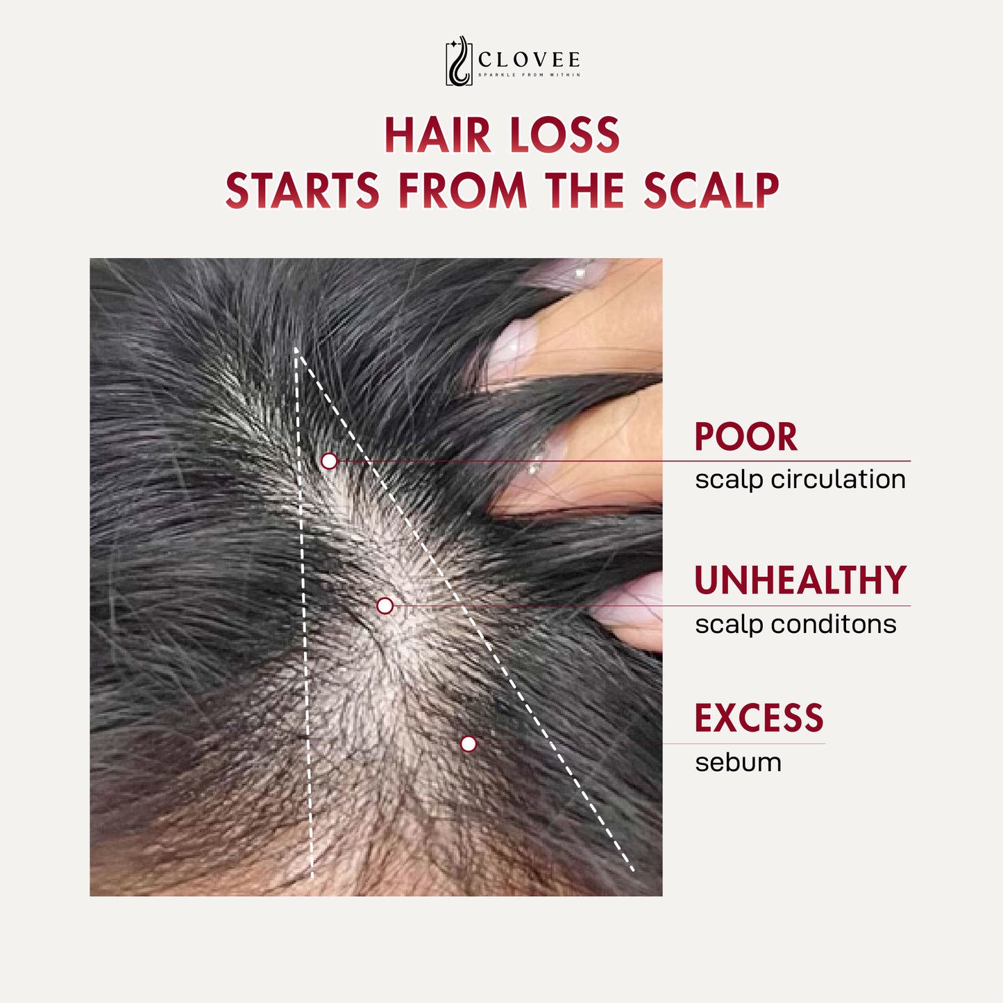 CLOVEE Hair Booster Serum - Set 1